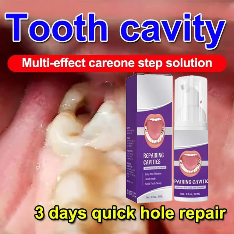 Teeth Whitening Cream - Pasta Gigi Pembersih Gigi Menghilangkan Noda