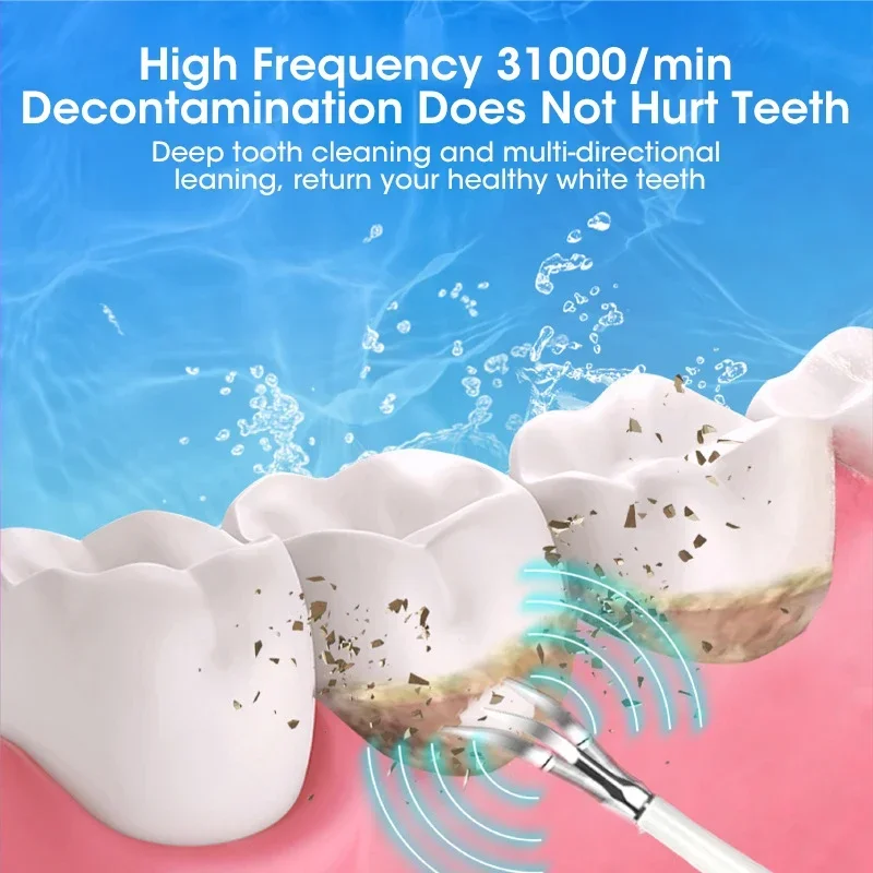 Scaler Ultrasonik untuk Pember - Teeth Whitening Uk ulasan dan harga