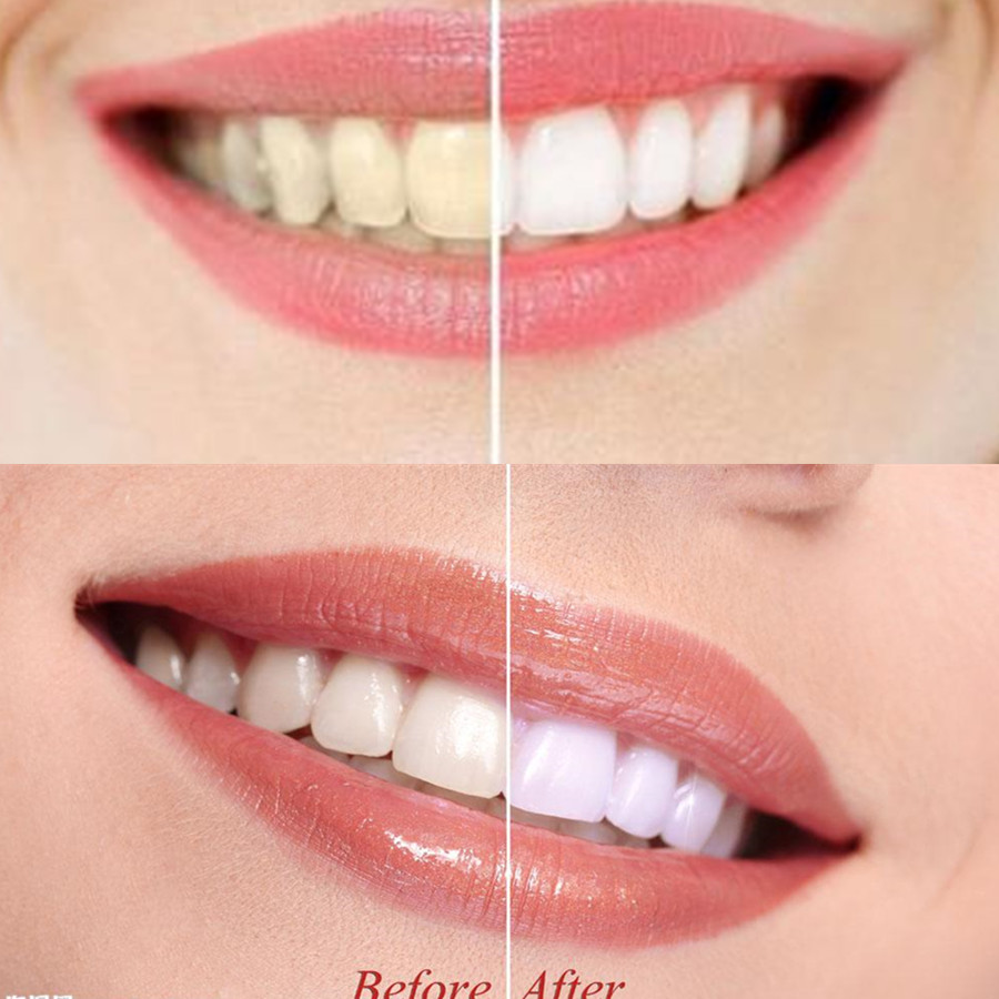 Arang Bambu Gigi Gigi Gigi Gig - Teeth Whitening Flash ulasan dan harga