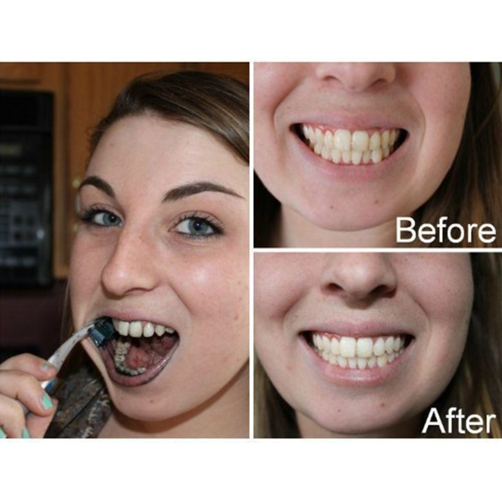 Arang Bambu Gigi Gigi Gigi Gig - Teeth Whitening Flash ulasan dan harga