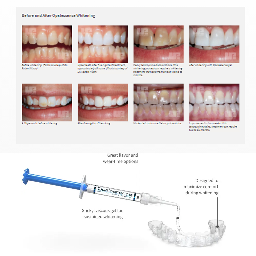 Opalescence Whitening 20% PF 2 - Teeth Whitening Flash ulasan dan harga