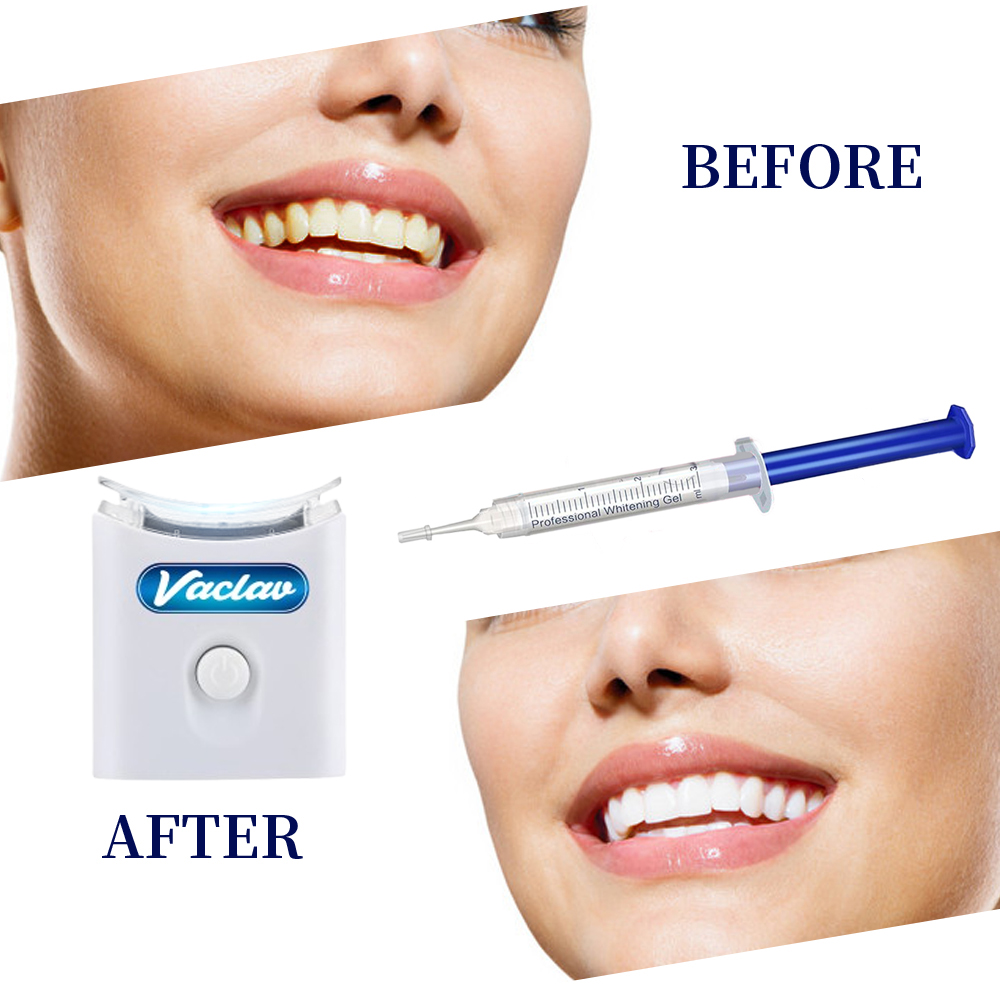 Kit Pemutih Gigi di Rumah deng - Teeth Whitening Gel Syringes ulasan dan harga