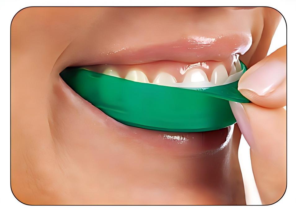 Ultradent Opalescence Go Strip - Teeth Whitening Opalescence Go ulasan dan harga