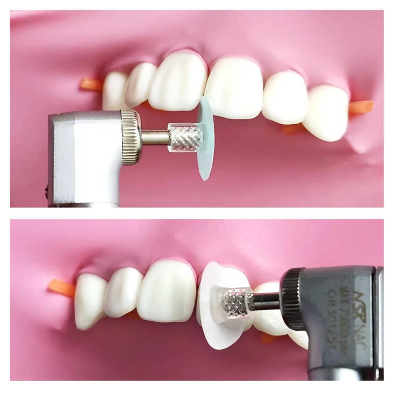 40Pcs Disc Poles Gigi Resin Ko - Teeth Whitening Uk ulasan dan harga