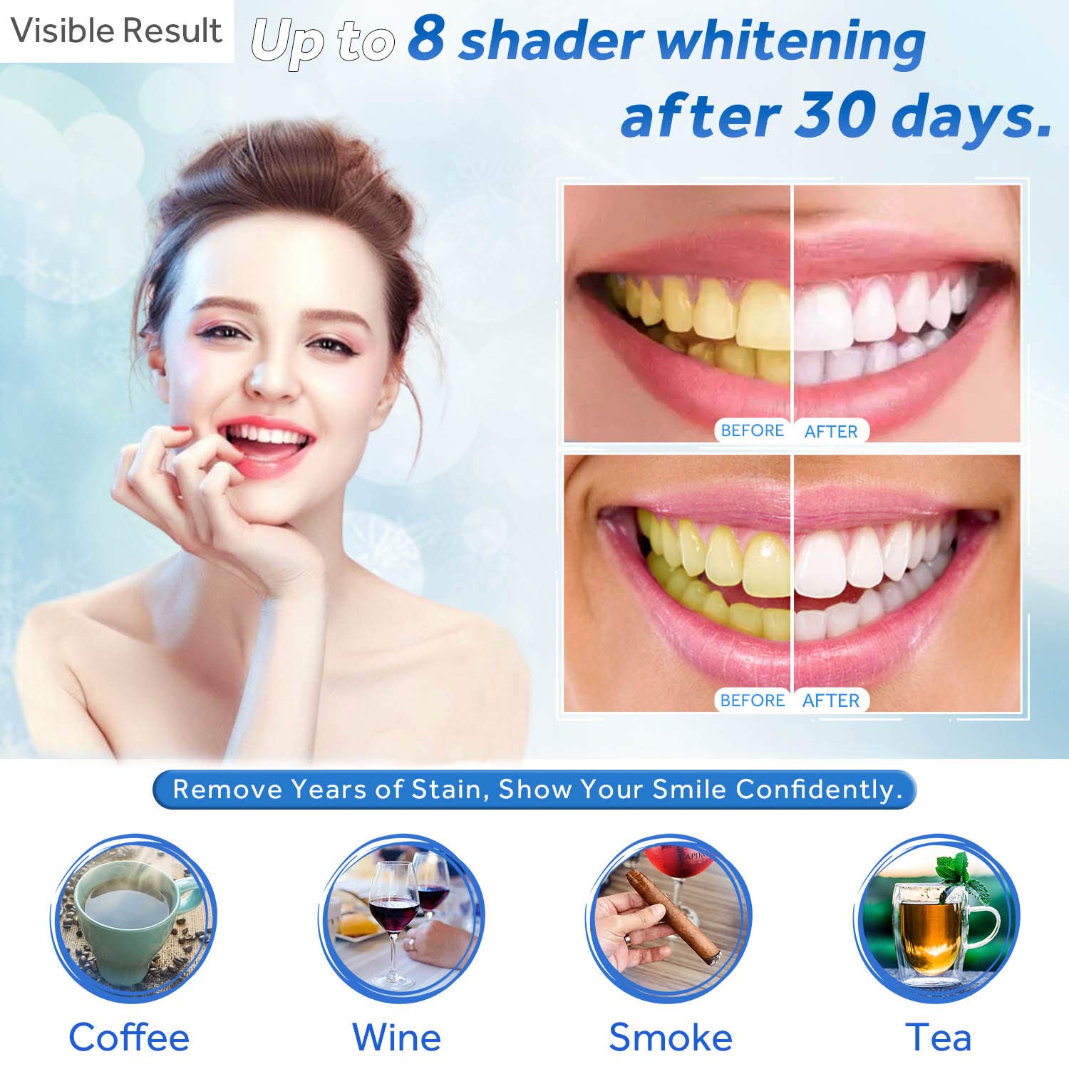 Gel Pemutih Gigi Isi Ulang Syr - Teeth Whitening Gel Syringes ulasan dan harga