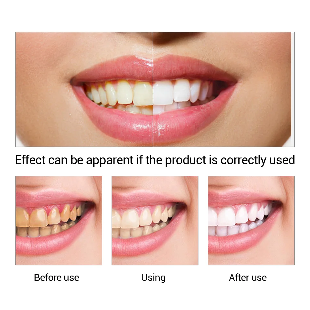 FTEENPLY Bubuk Esensi Pemutih  - Teeth Whitening Flash ulasan dan harga