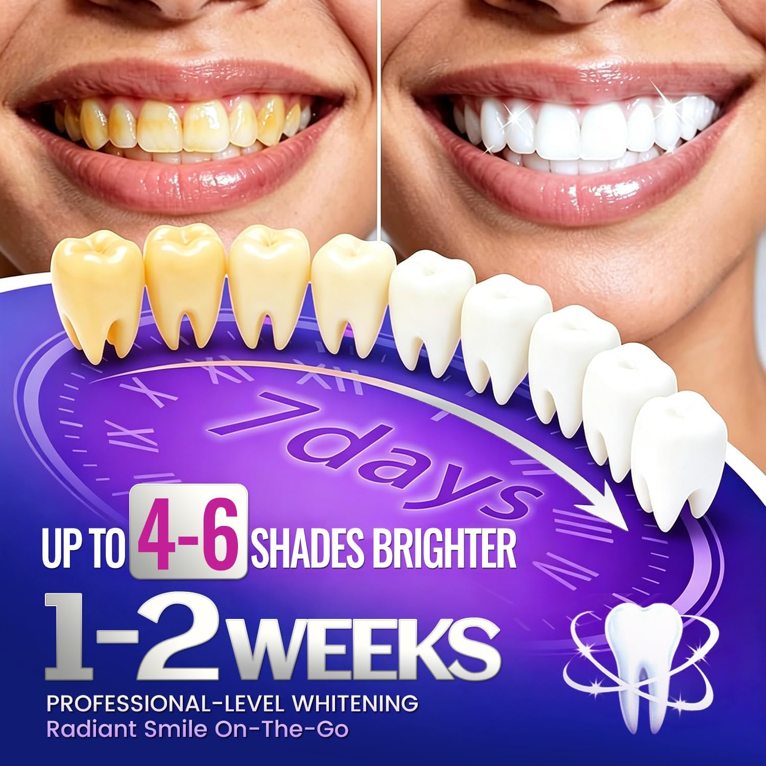 7 pasang Strip Pemutih Gigi un - Teeth Whitening Retainer ulasan dan harga