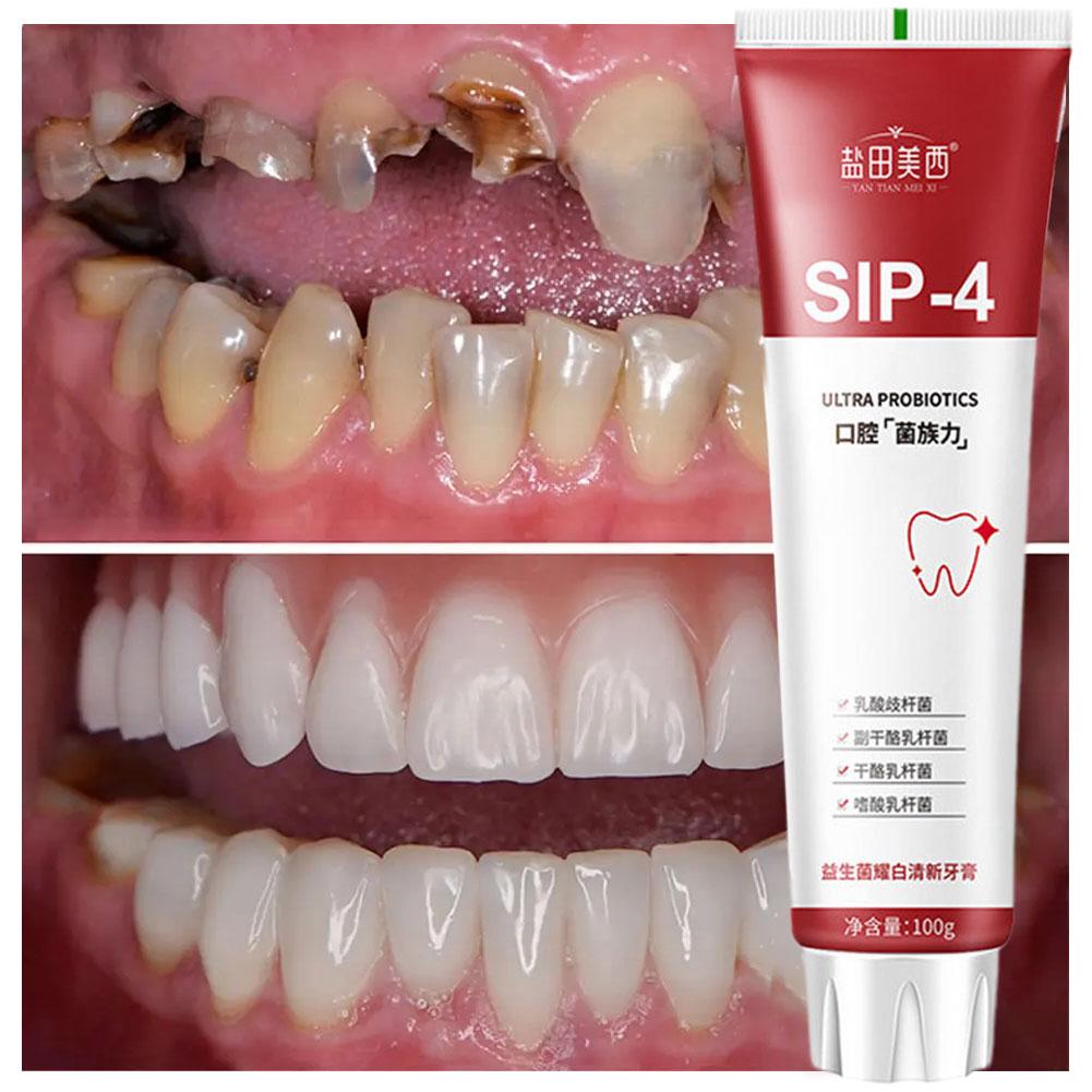 100g Pasta Gigi Pemutih Probio - Teeth Whitening Cream ulasan dan harga