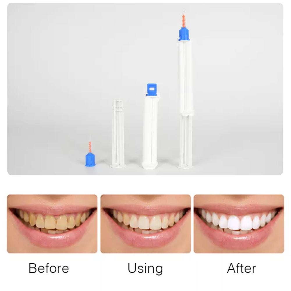 10/5/2 Buah Jarum Suntik Gigi  - Teeth Whitening Gel Syringes ulasan dan harga