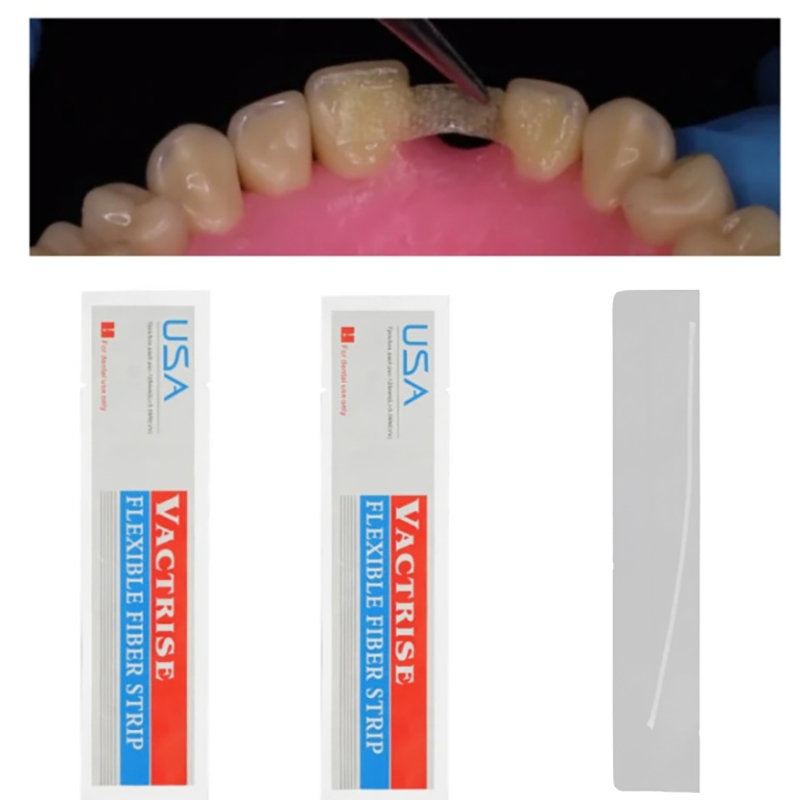 1 Buah Strip Serat Fleksibel G - Teeth Whitening Retainer ulasan dan harga