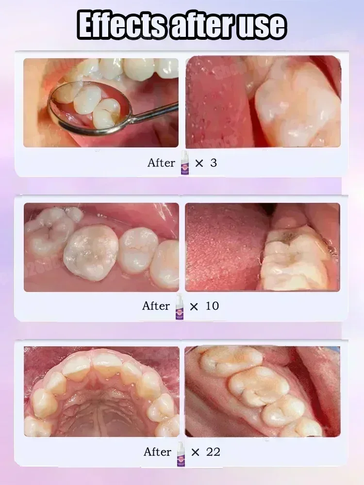 Pasta Gigi Pembersih Gigi Meng - Teeth Whitening Cream ulasan dan harga
