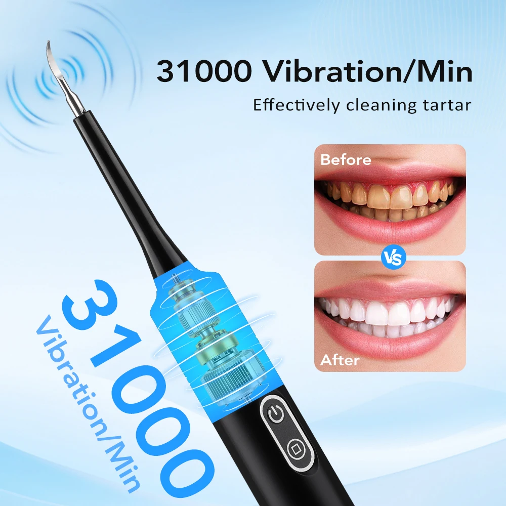 Alat Pembersih Karang Gigi Ele - Teeth Whitening And Stain Removal ulasan dan harga