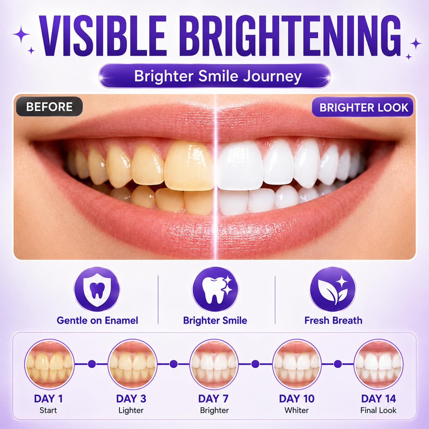7/14/21 Buah Strip Pemutih Gig - Teeth Whitening Retainer ulasan dan harga